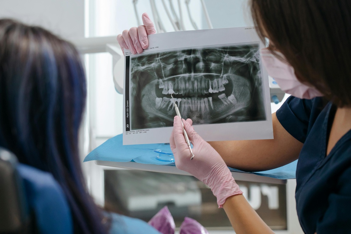 dental exams and x rays 2