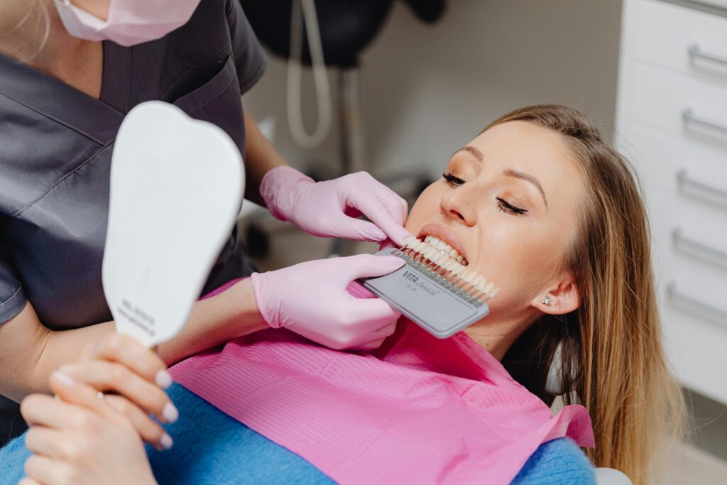 dental veneers 1