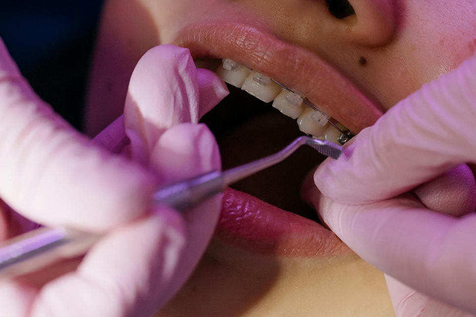orthodontic 3