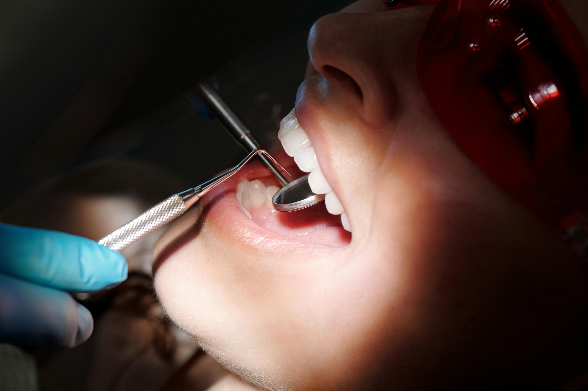 teeth whitening 2